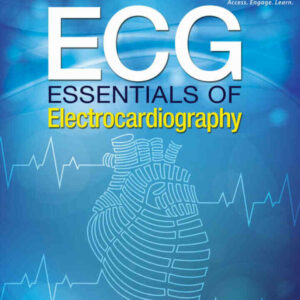 ECG: Essentials of Electrocardiography 1st Edition